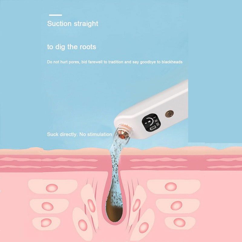 QIAOYANG συσκευή καθαρισμού προσώπου QA-T663 – QIAOYANG face cleaning device QA-T663